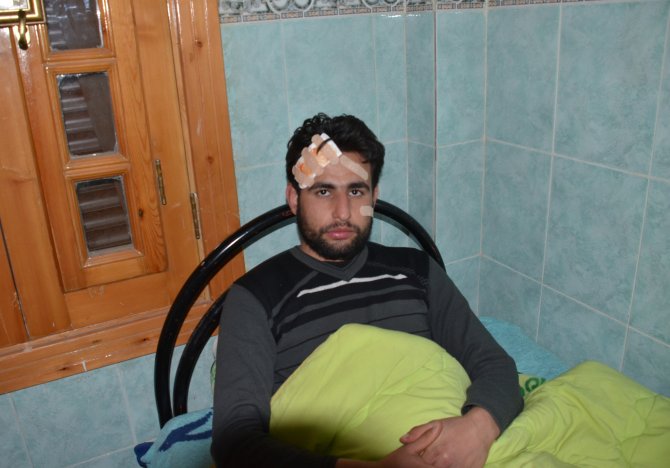 Aa Kameramanı Suriye'de Roket Saldırısında Yaralandı