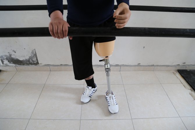 Savaşın Parçaladığı Bedenler Protezle Tamamlanıyor