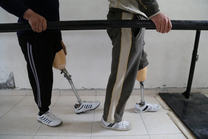Savaşın Parçaladığı Bedenler Protezle Tamamlanıyor