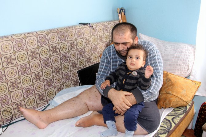 Tek Hayali Çocuklarını Parka Götürebilmek