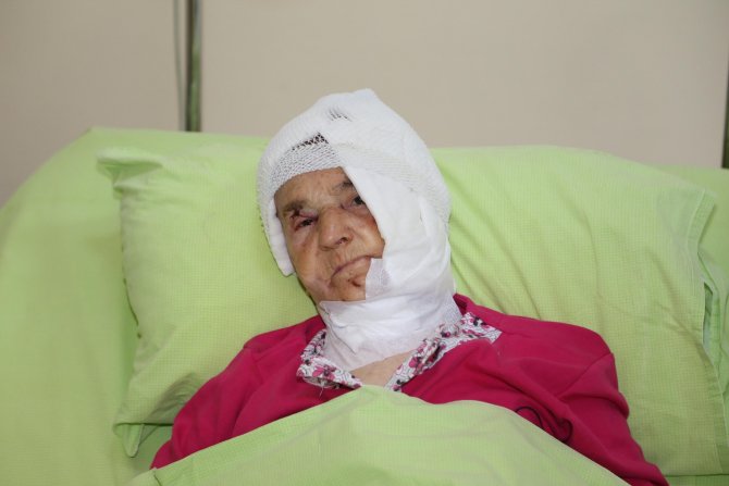 Rize'de Ayının Saldırısına Uğrayan Yaşlı Kadın Ağır Yaralandı