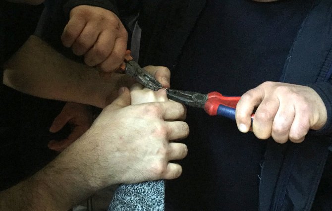 Parmağındaki yüzüğü itfaiye çıkardı