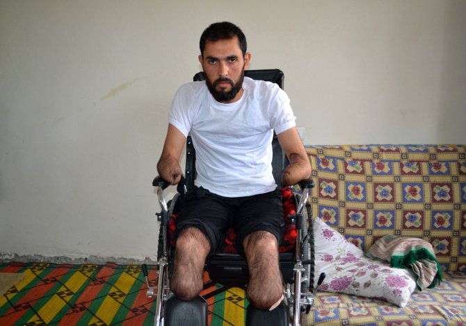 El ve ayaklarını kaybeden Suriyeli genç protez bekliyor