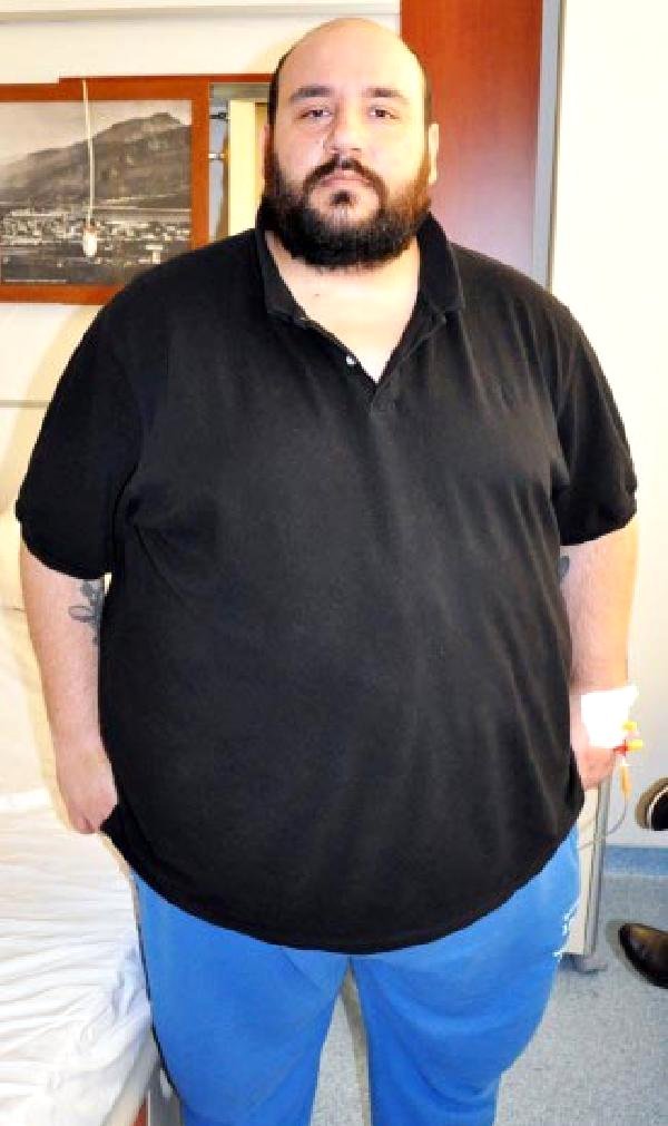 Bir yılda 110 kilo verdi