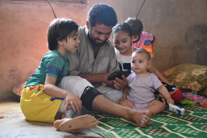 "Oğlum uyuyunca kesik bacağına bakıp ağlıyorum"