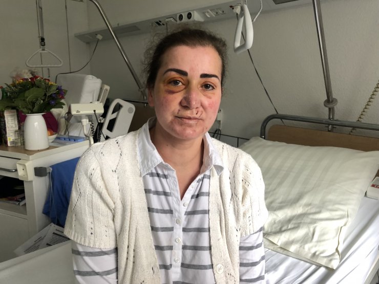 Almanya'da Türk kadına tramvayda saldırı