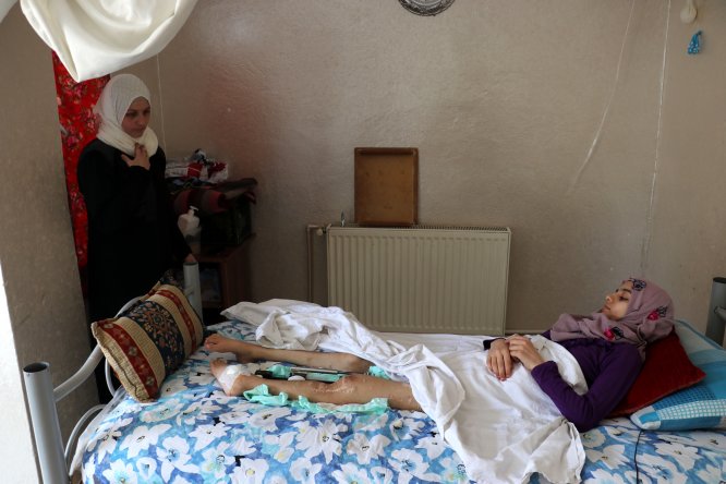 Suriyeli çocuk vücudunda şarapnel parçalarıyla yatağa mahkum yaşıyor