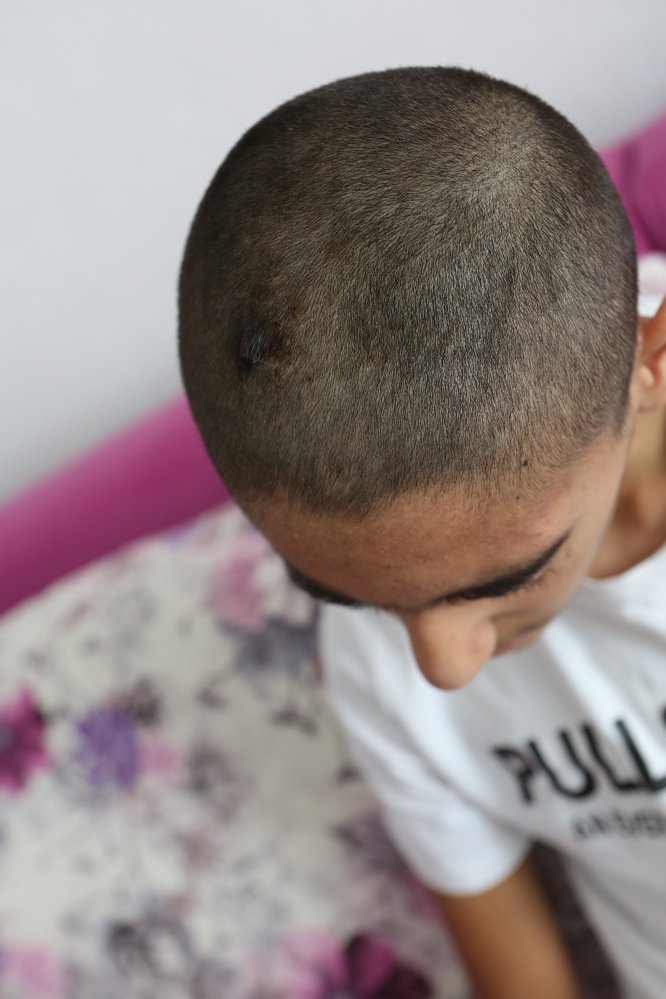 Maganda kurşunuyla yaralanan Efe'nin okul özlemi