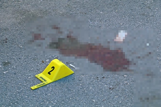 Bodyguardların saldırısına uğrayan iş adamı, yaşam mücadelesini kaybetti