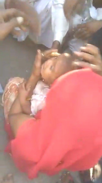 Kafası tencereye sıkışan küçük kızı kurtarma operasyonu