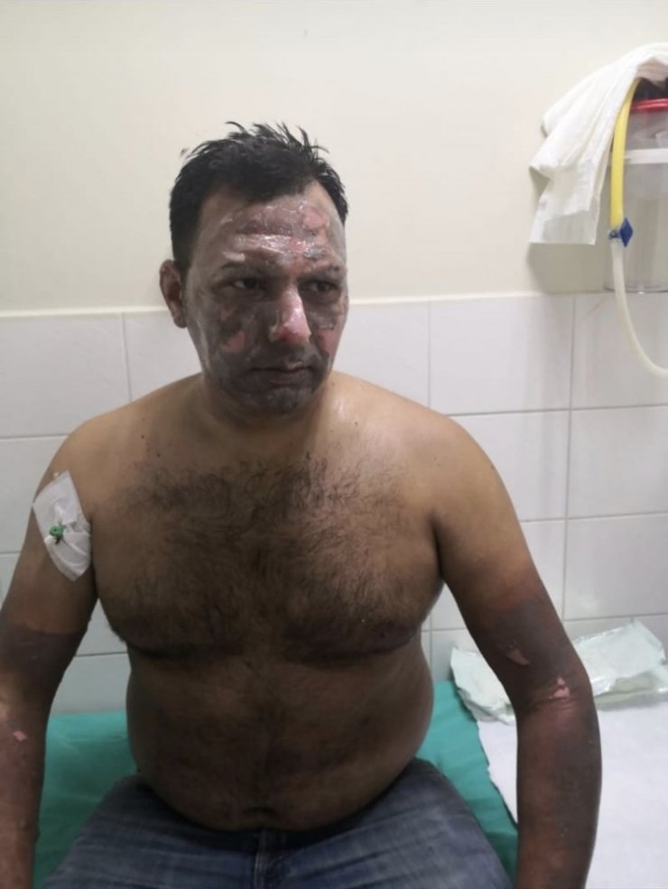 Kebapçıda fırın patladı, iş yeri sahibi ağır yaralandı: O anlar kamerada