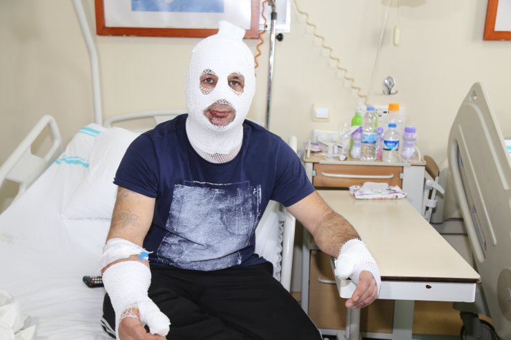 Tinerle temizlik yaparken sigara yakınca kıyafeti alev aldı