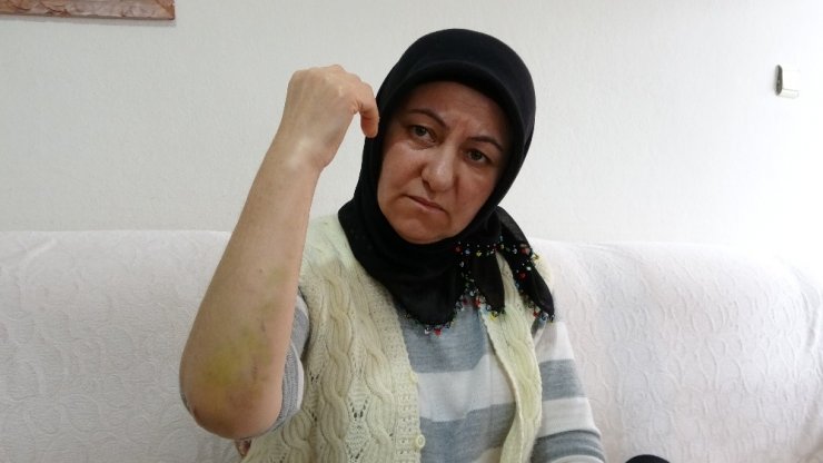 Uçak kazasından yaralı kurtulan kadın: “Halen şoktayım”